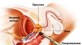 Podwyższona temperatura z zapaleniem prostaty Temperatura ostrego zapalenia gruczołu krokowego